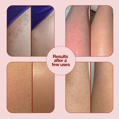 Silk Exfoliating Glove